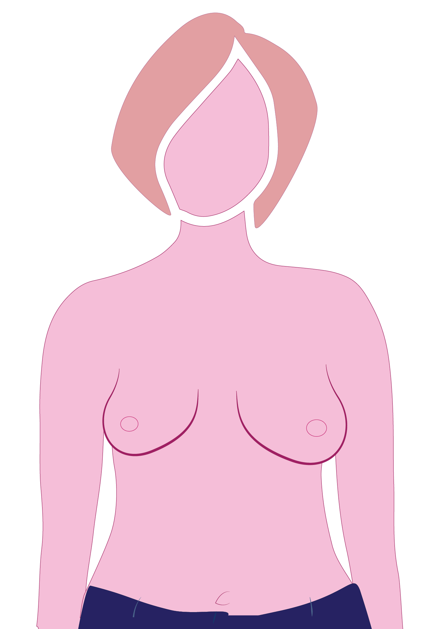 Mastectomy surgery type 6